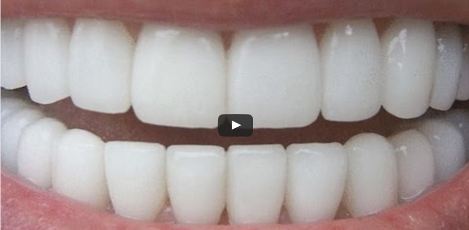  Whiter, Brighter Teeth in 2 Weeks |Homemade Teeth Whitening that Works