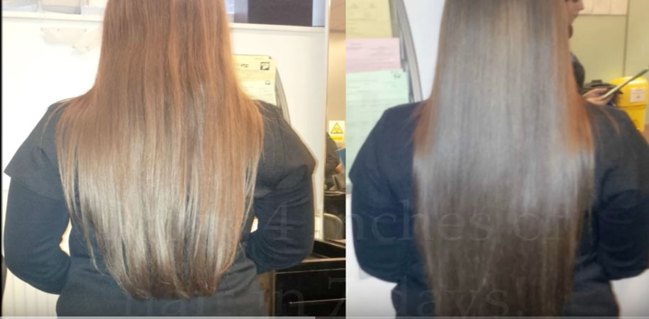 Grow Your Hair Fast 1 2 Inch In 7 Days Using The Inversion Method Easy Life Hacks